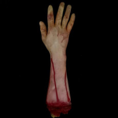 Bloody Arm